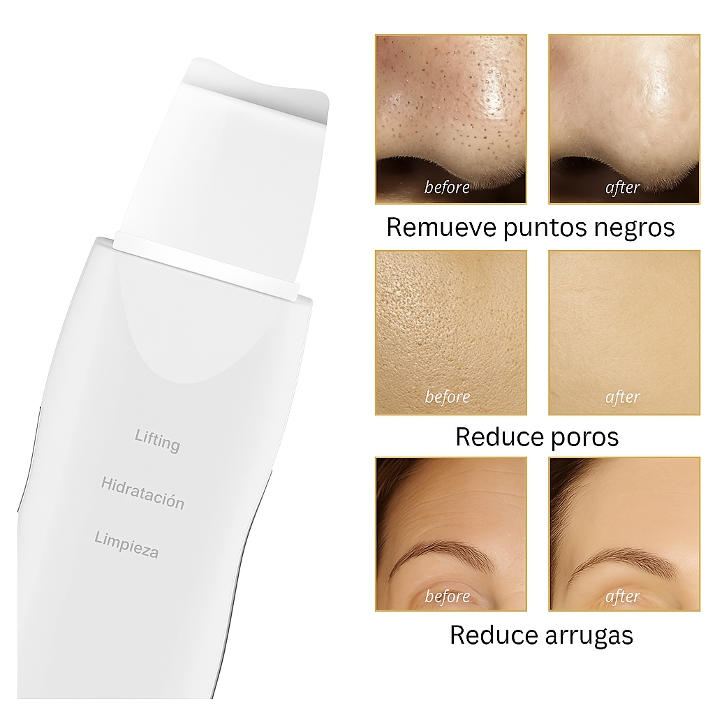 LIMPIADOR ESPÁTULA FACIAL REMOVEDOR DEPURADOR